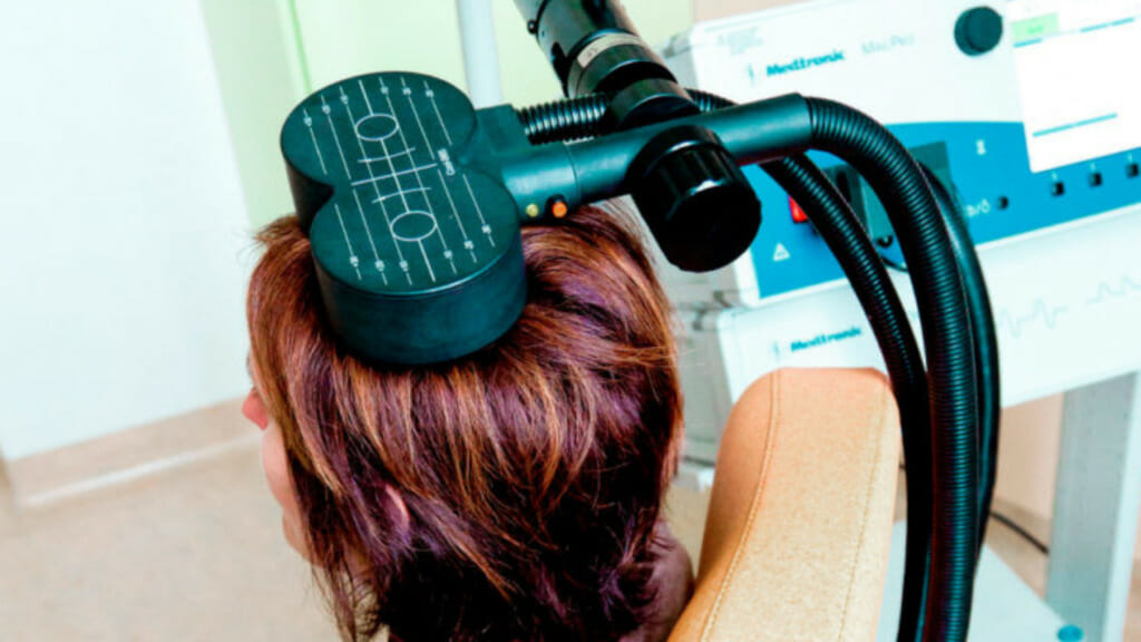 transcranial magnetic stimulation tms therapy